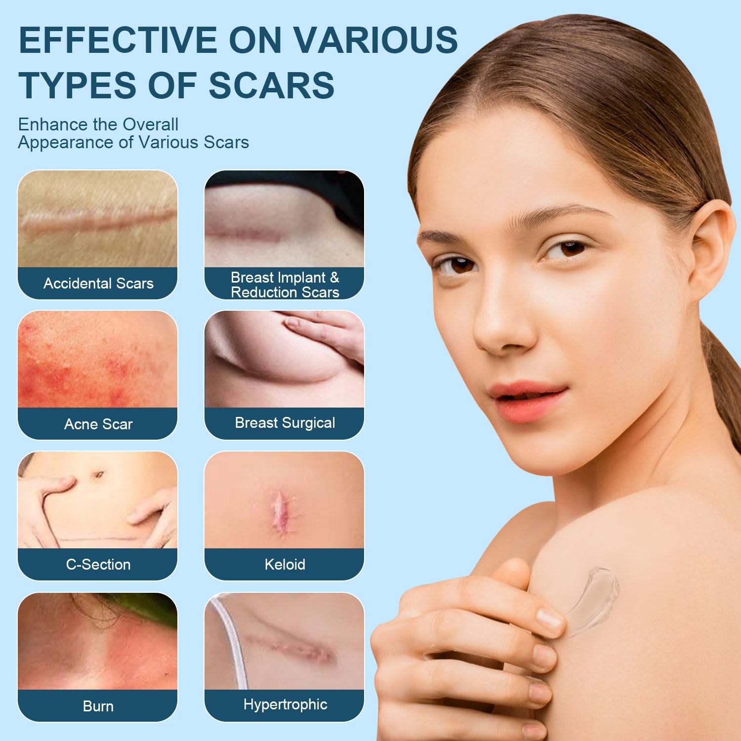 Mitgary Advanced Scar Gel, Silicone Scar Gel, Treats Old and New Scars, Reduces the Appearance of Scars from, Body, Face, Stretch Marks, Surgical Scar, Keloids, Acne, Burns and More, 50g (1.7 Oz) - Image 4