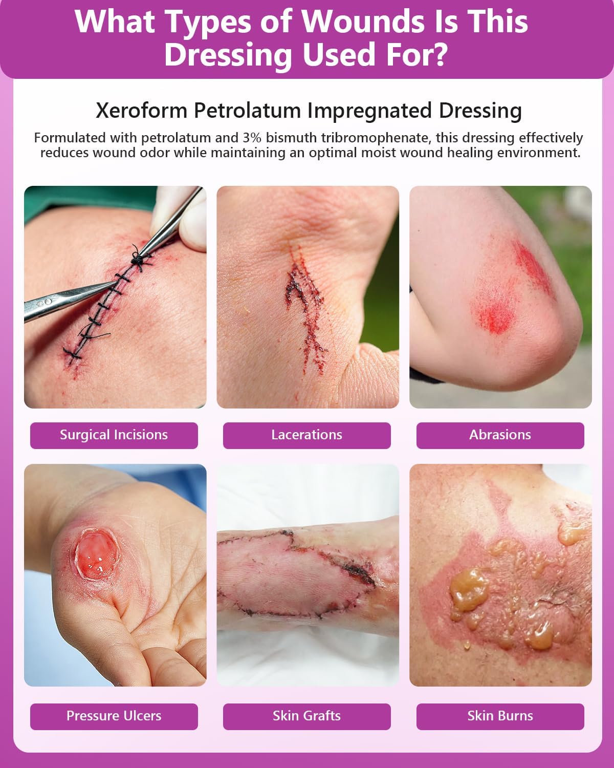 Xeroform Petrolatum Dressing 2"x2" Pack of 25, Non Stick Pads for Wounds, Non-Adherent Gauze, Fine Mesh Sterile for Wound Care, Burns, Lacerations, Skin Grafts & Surgical Incisions - Image 5