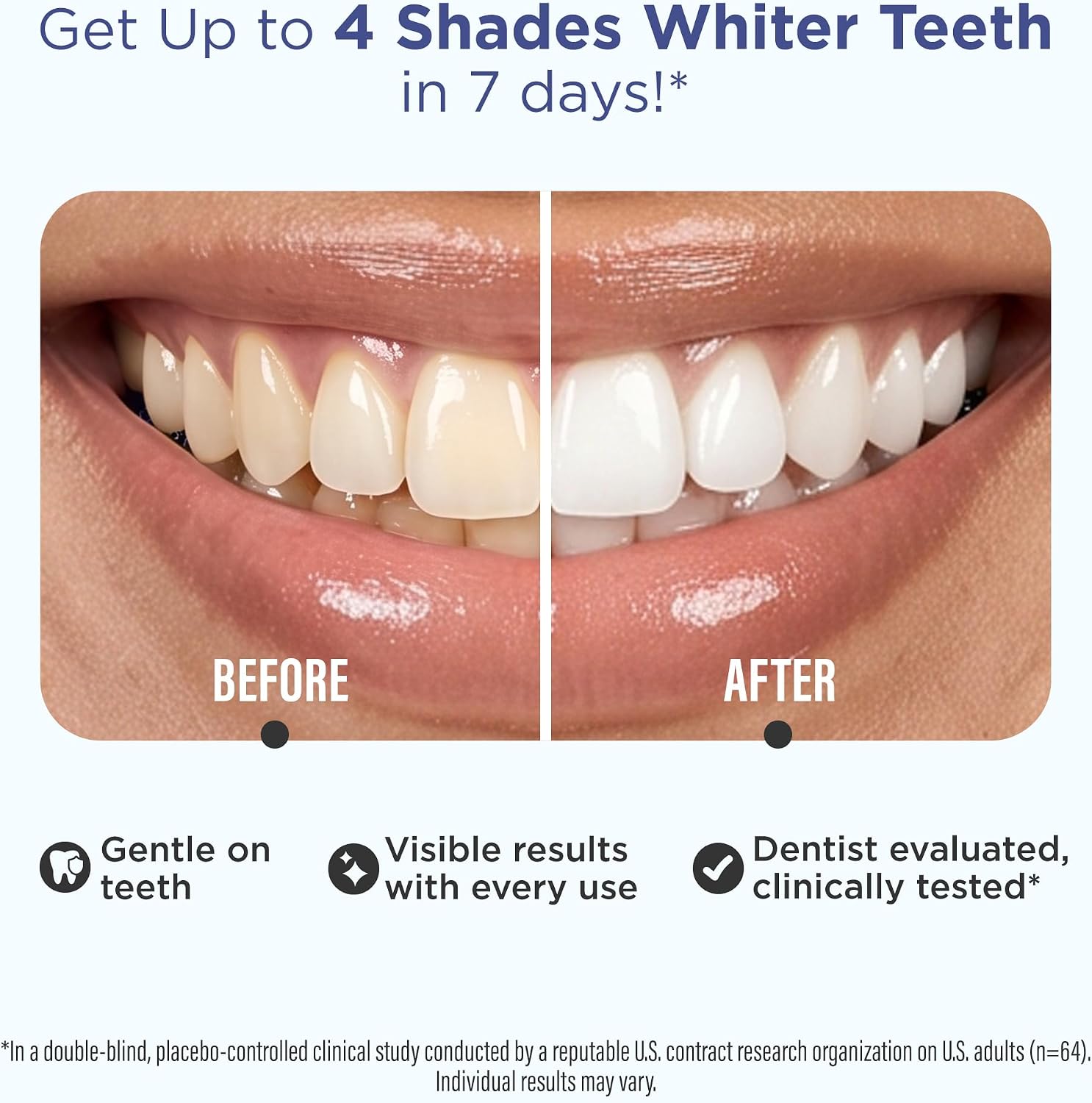 GuruNanda Teeth Whitening Strips Kit - 7-Day Treatment with Non-Slip, Dry Strip Technology - Whitening Designed with Care for a Brighter Smile - Image 3