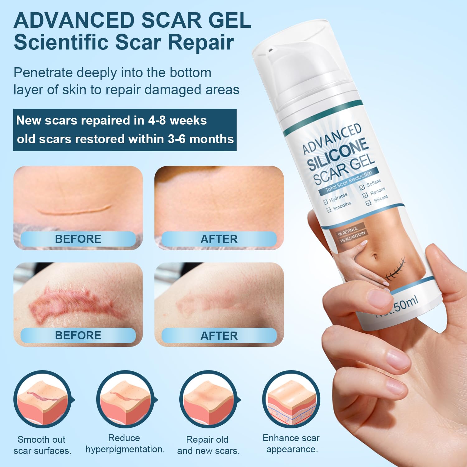 Mitgary Advanced Scar Gel, Silicone Scar Gel, Treats Old and New Scars, Reduces the Appearance of Scars from, Body, Face, Stretch Marks, Surgical Scar, Keloids, Acne, Burns and More, 50g (1.7 Oz) - Image 3