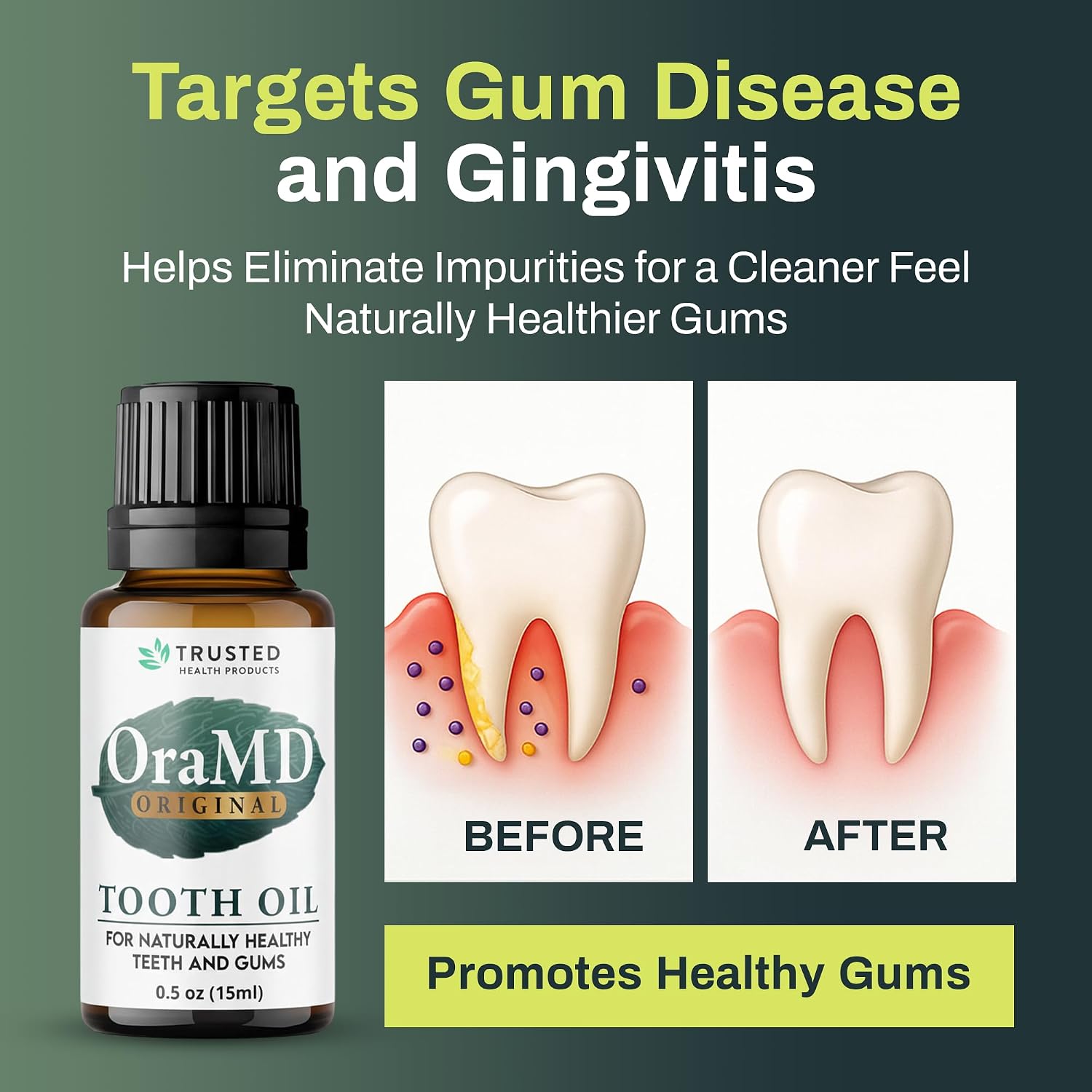 OraMD 4-in-1 Original Tooth Oil - Gum Disease Gingivitis Treatment (1 Pack) | Clinically Tested, Periodontal Disease Treatment, Sensitive Teeth & Gums, Chemical-Free Solution, 250,000+Satisfied Customers - Image 2