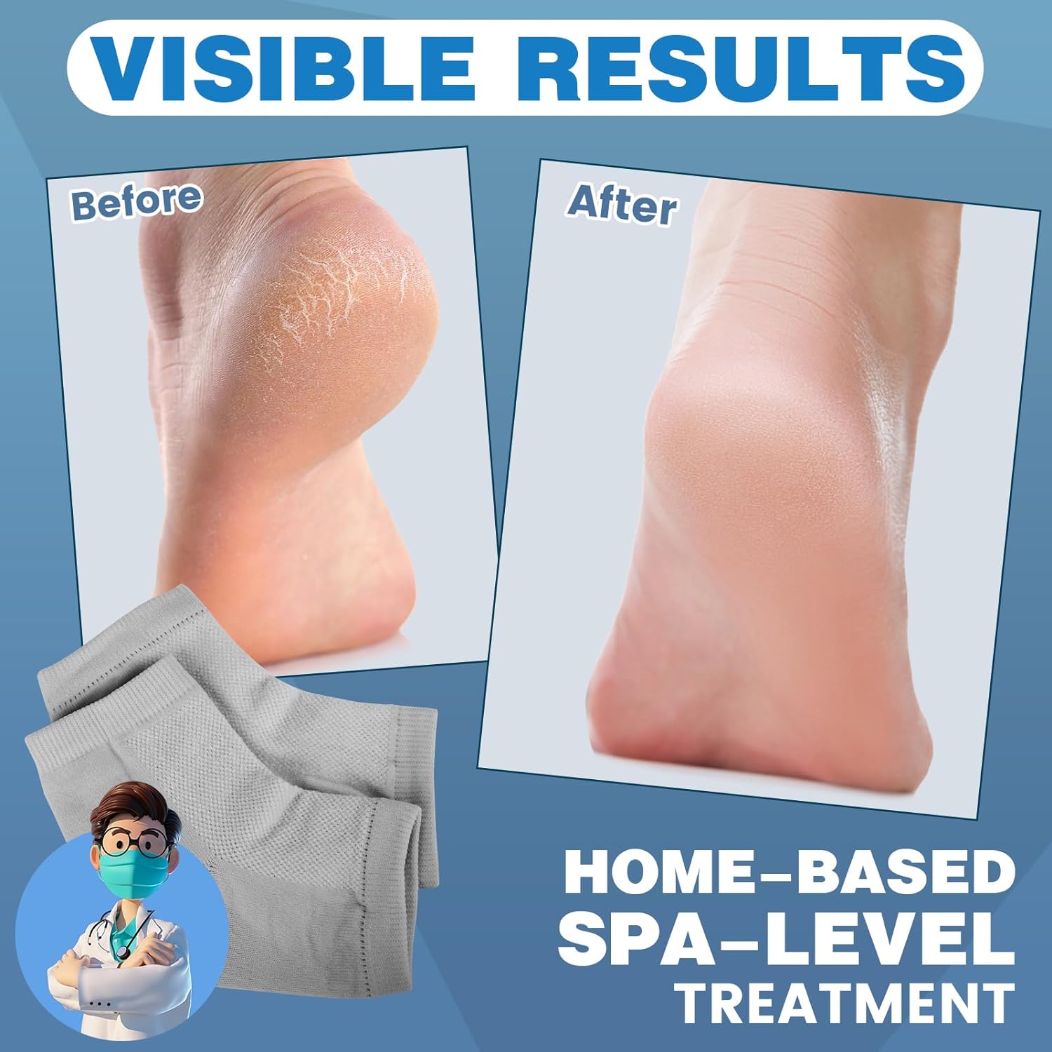 TEAWOO Moisturizing Heel Socks - 6 Pairs for Dry Cracked Feet | Toeless Gel Socks for Hydration and Repair, Soften and Hydrate Dry Cracked Feet Heels, Gel Socks for Dry Cracked Feet - Image 2