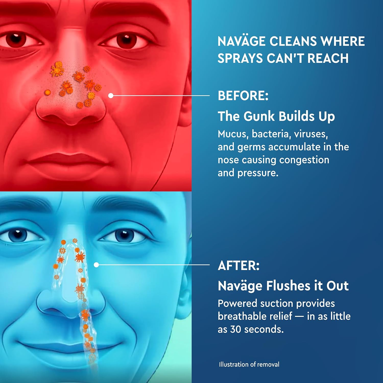 NAVAGE® Starter Bundle: Nose Cleaner, 30 SaltPods, Congestion Relief | Complete Sinus Care Kit: Powered Nasal Irrigation System w/ 30 Pre-Measured SaltPods for Clinically Proven Benefits - Image 9