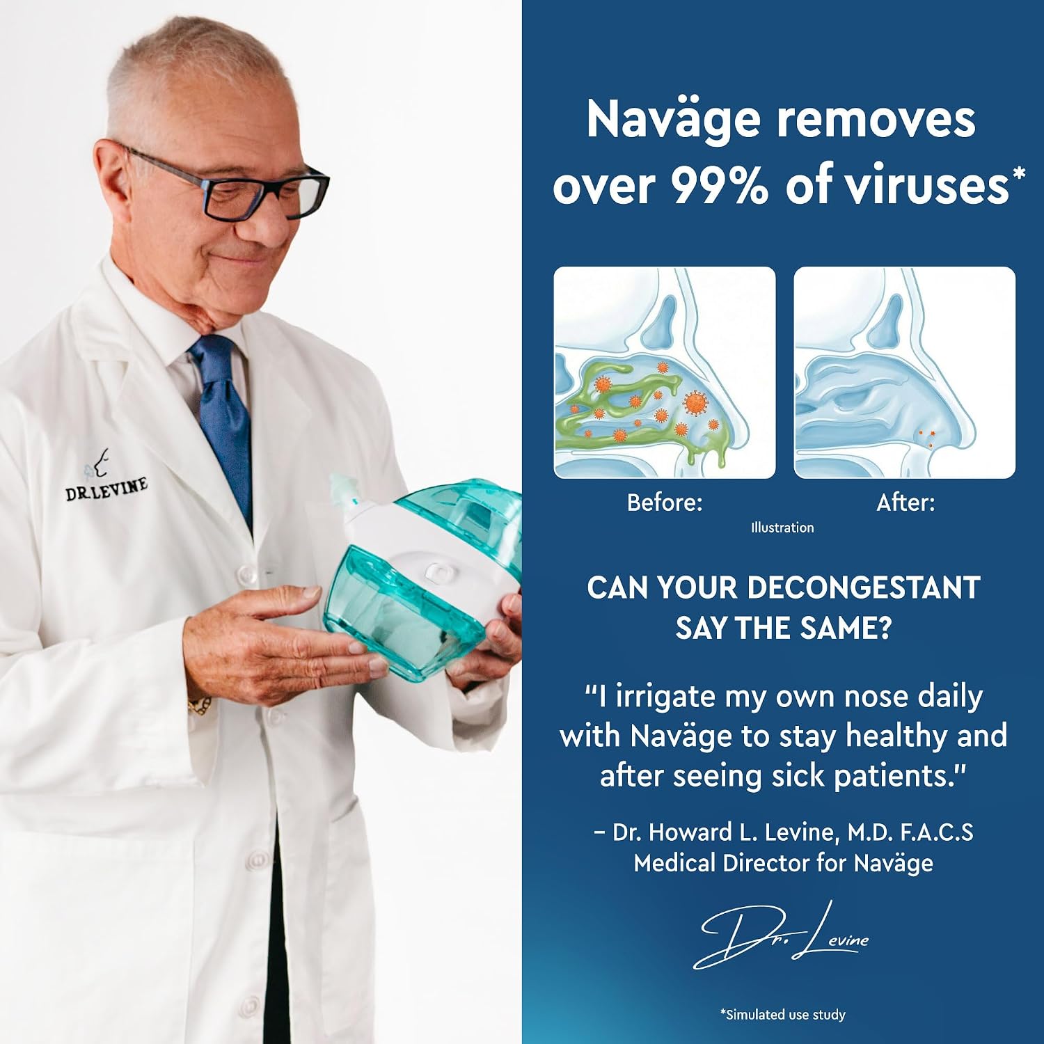 NAVAGE® Starter Bundle: Nose Cleaner, 30 SaltPods, Congestion Relief | Complete Sinus Care Kit: Powered Nasal Irrigation System w/ 30 Pre-Measured SaltPods for Clinically Proven Benefits - Image 3