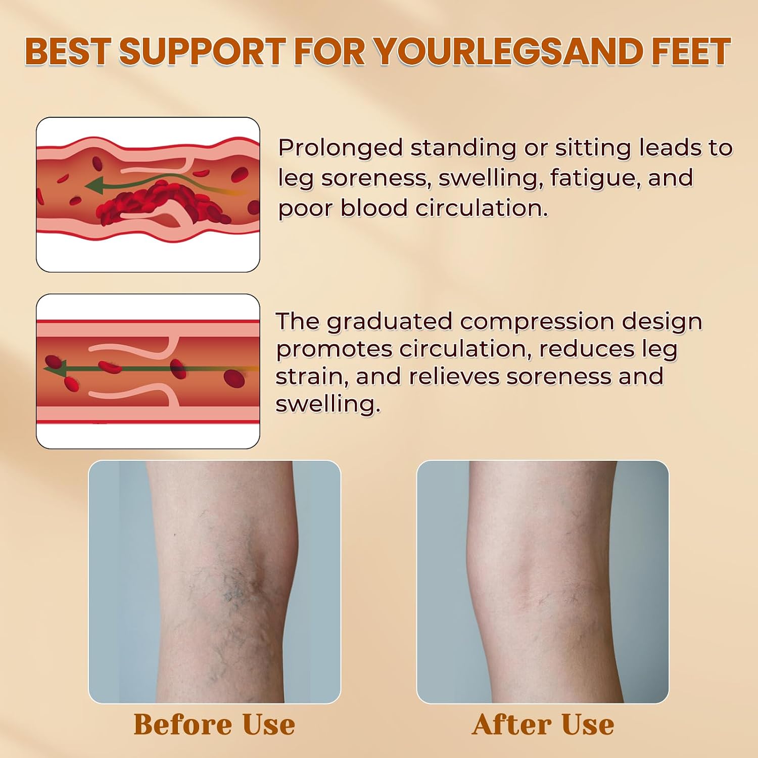 Thigh High Compression Socks Compression Stockings 2 Pairs Medical | 20-30mmHg Open Toe Compression Socks Women&Men Silicone Dot Band for Sport Swelling Varicose Veins - Image 5