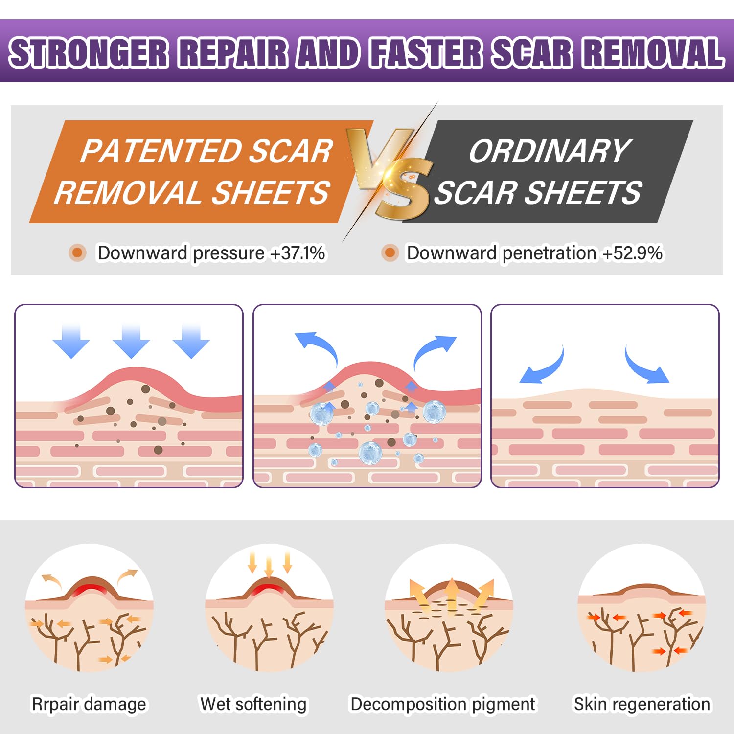 Silicone Scar Sheets, Medical Grade Silicone Scar Tape for Old & New Scars | Scar Tape for Surgical, Hypertrophic, Keloid, C-Section, Burn Scars, Reusable Professional Scars Removal (1.6"X59" Roll-1.5M) - Image 3