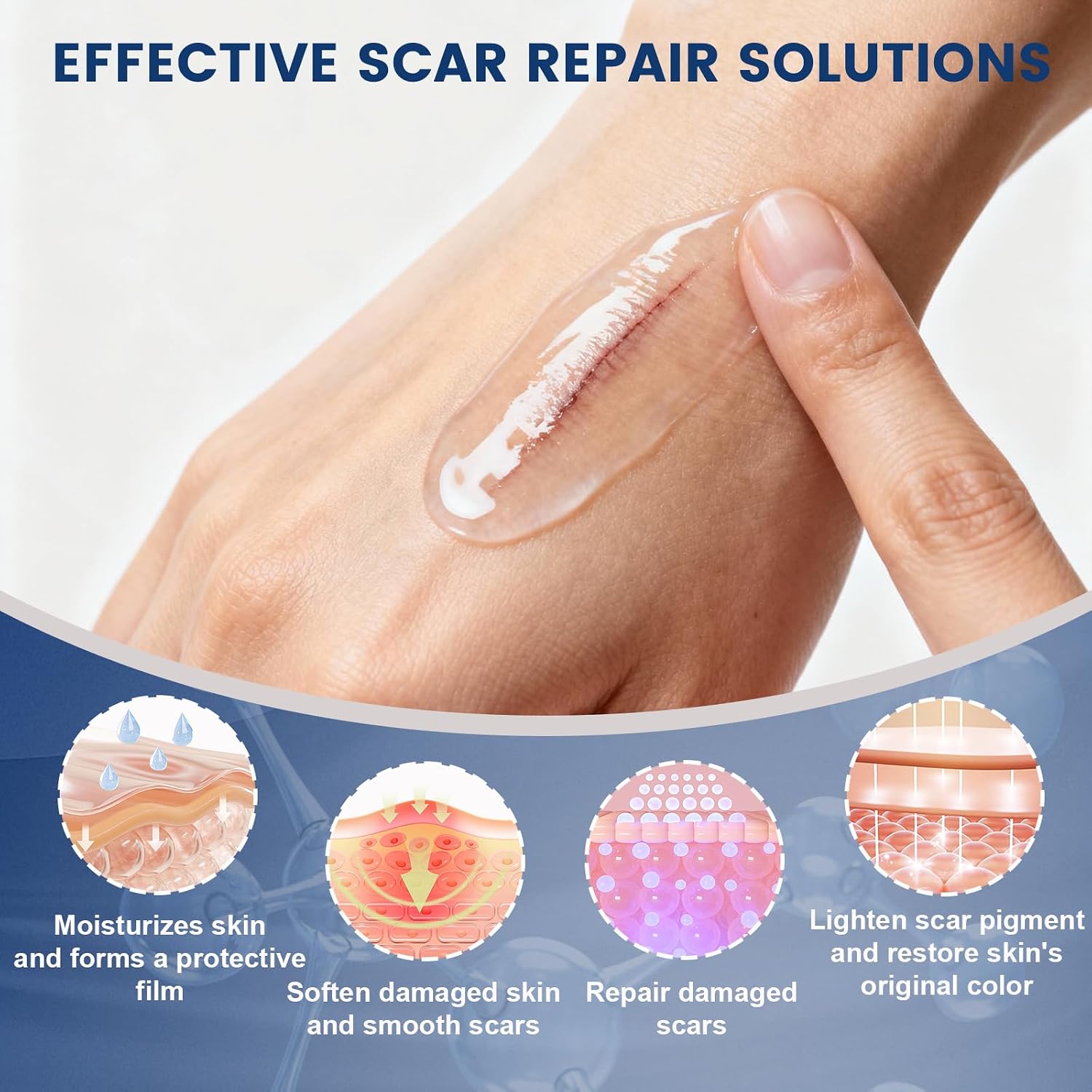 Rvlaim 100% Advanced Silicone Scar Gel for Old & New Scars,1.7oz/50ml | Hypoallergenic and Fast-absorbing Effective for Surgical, Burns, Acne, C-Section, Keloid Scars and Stretch Marks - Image 5