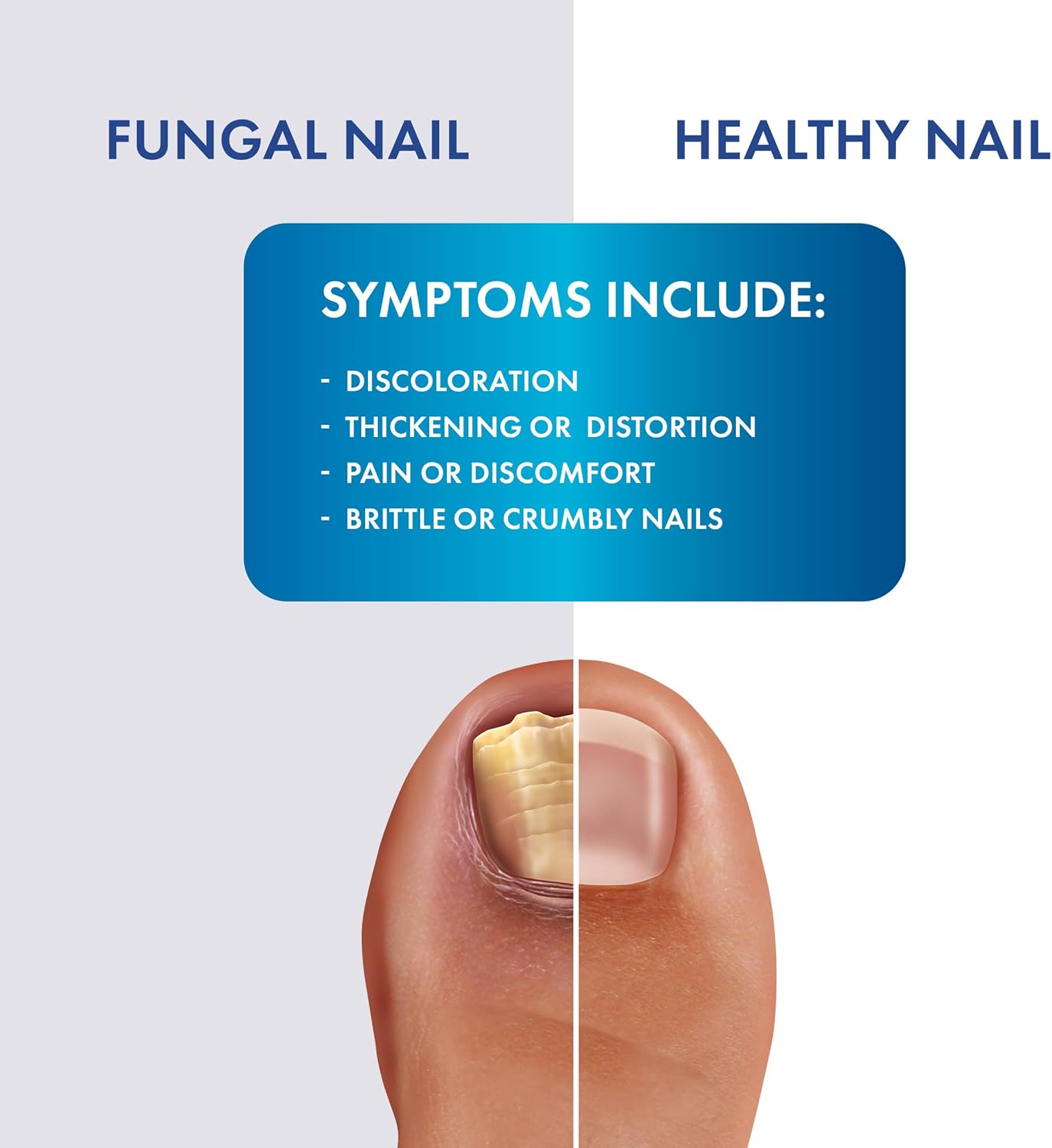 Fungal Shield Max Strength Brush-On Antifungal Liquid, 2-Pack | 2-pack brush-on antifungal liquid for max strength fungal relief, precise no-mess application - Image 3