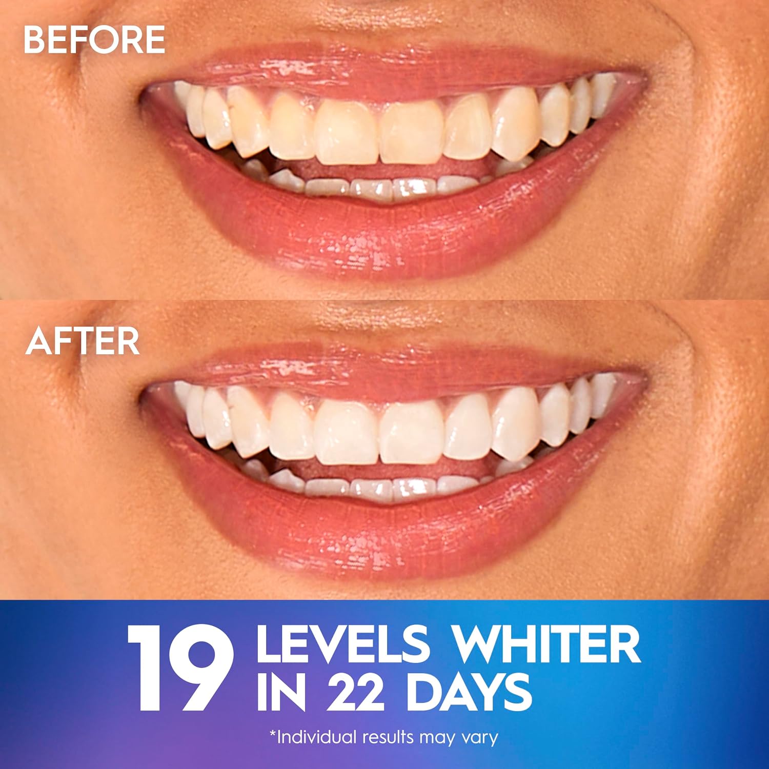 Crest Teeth Whitening Strips, Crest 3D Whitestrips Professional Effects, Enamel Safe Teeth Whitening Kit, 22 Treatments (44 Strips), Professional-Level Whitening, 19 Levels Whiter - Image 4