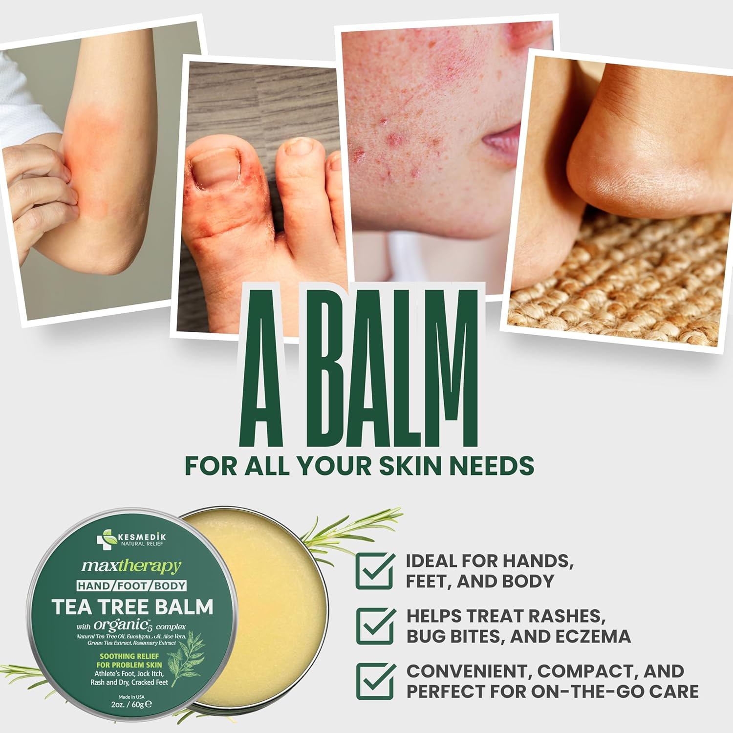 KESMEDIK Tea Tree Oil Balm for Skin, Soothes Itching, Rashes & Dry Skin, Antifungal Defense for Athlete’s Foot, Jock Itch, Chafing, Bug Bites & Eczema, Natural, Effective & Safe for All Ages - Image 3