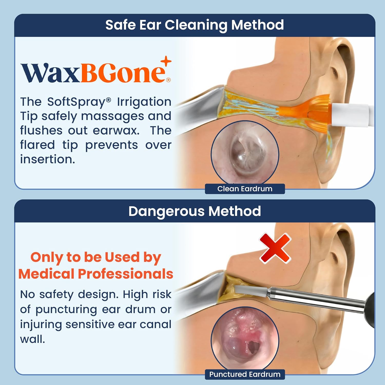 Ear Wax Removal Kit with SoftSpray Irrigation Tips, 4X High Output Sprayer & Ear Basin - Safe, Fast, Gentle Ear Cleaning Kit for Adults & Kids at Home - Premium Kit with Otoscope + Ear Drops | Complete premium system combines 4X cleaning power, patented SoftSpray® tips, otoscope and drops for fast, gentle home use - Image 9