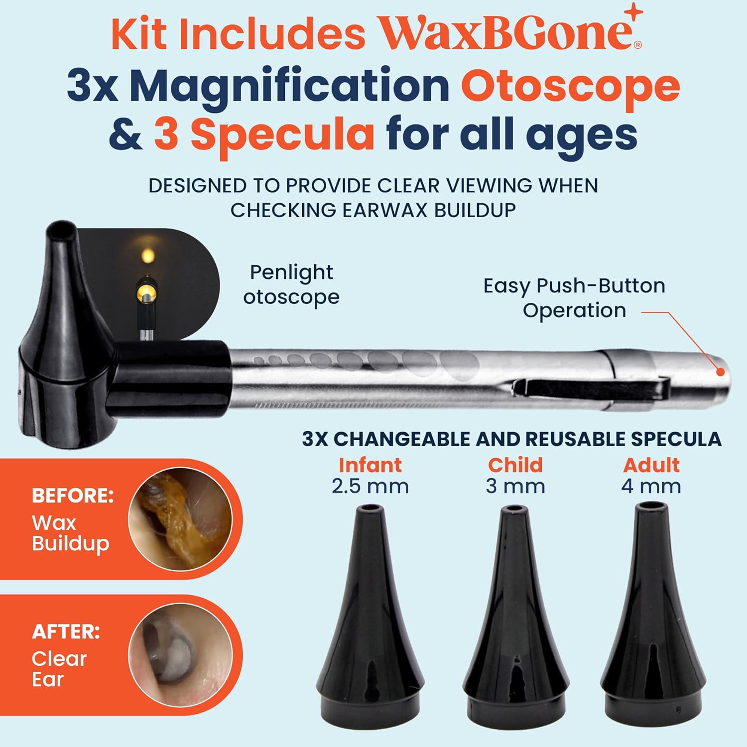 Ear Wax Removal Kit with SoftSpray Irrigation Tips, 4X High Output Sprayer & Ear Basin - Safe, Fast, Gentle Ear Cleaning Kit for Adults & Kids at Home - Premium Kit with Otoscope + Ear Drops | Complete premium system combines 4X cleaning power, patented SoftSpray® tips, otoscope and drops for fast, gentle home use - Image 7