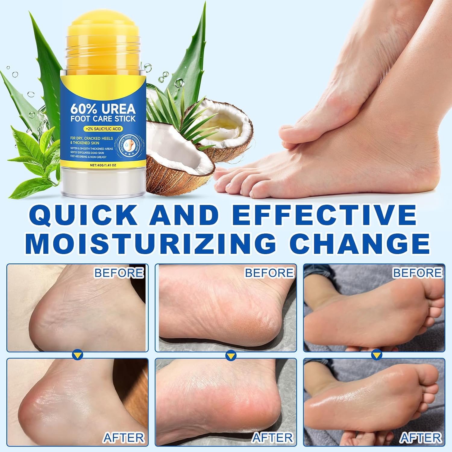 FANSHI 2 PCS Urea Stick 60% High Potency, Foot Care Urea Stick for Deeply Moisturizing & Fast Absorbing, Exfoliation for Dry Cracked Heels & Thickened Skin - Image 6