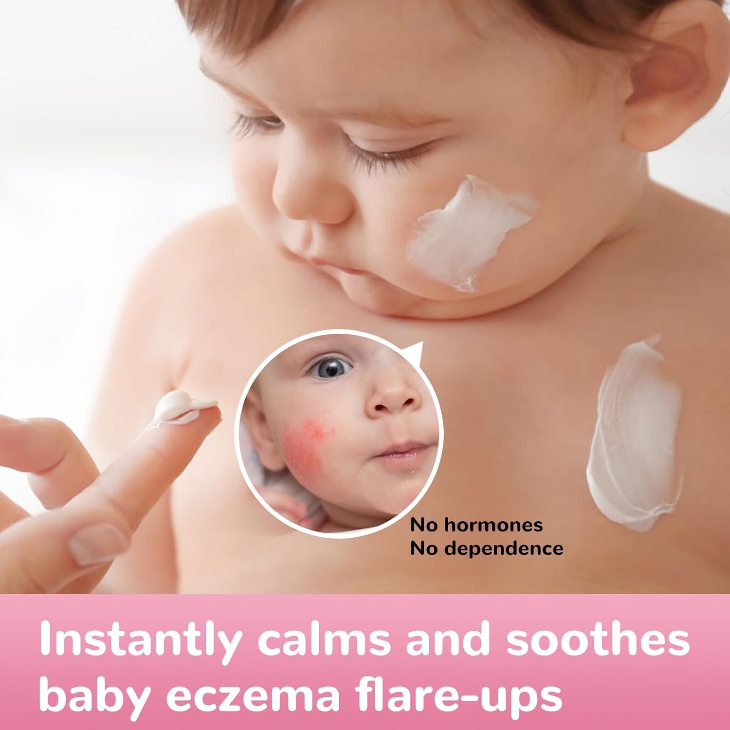 Baby Eczema Relief Cream, All-Natural Herbal Formula for Safe, Soothing Skin Protection Against Rashes, Dryness, Redness, and Itchiness, 3.53oz - Image 2
