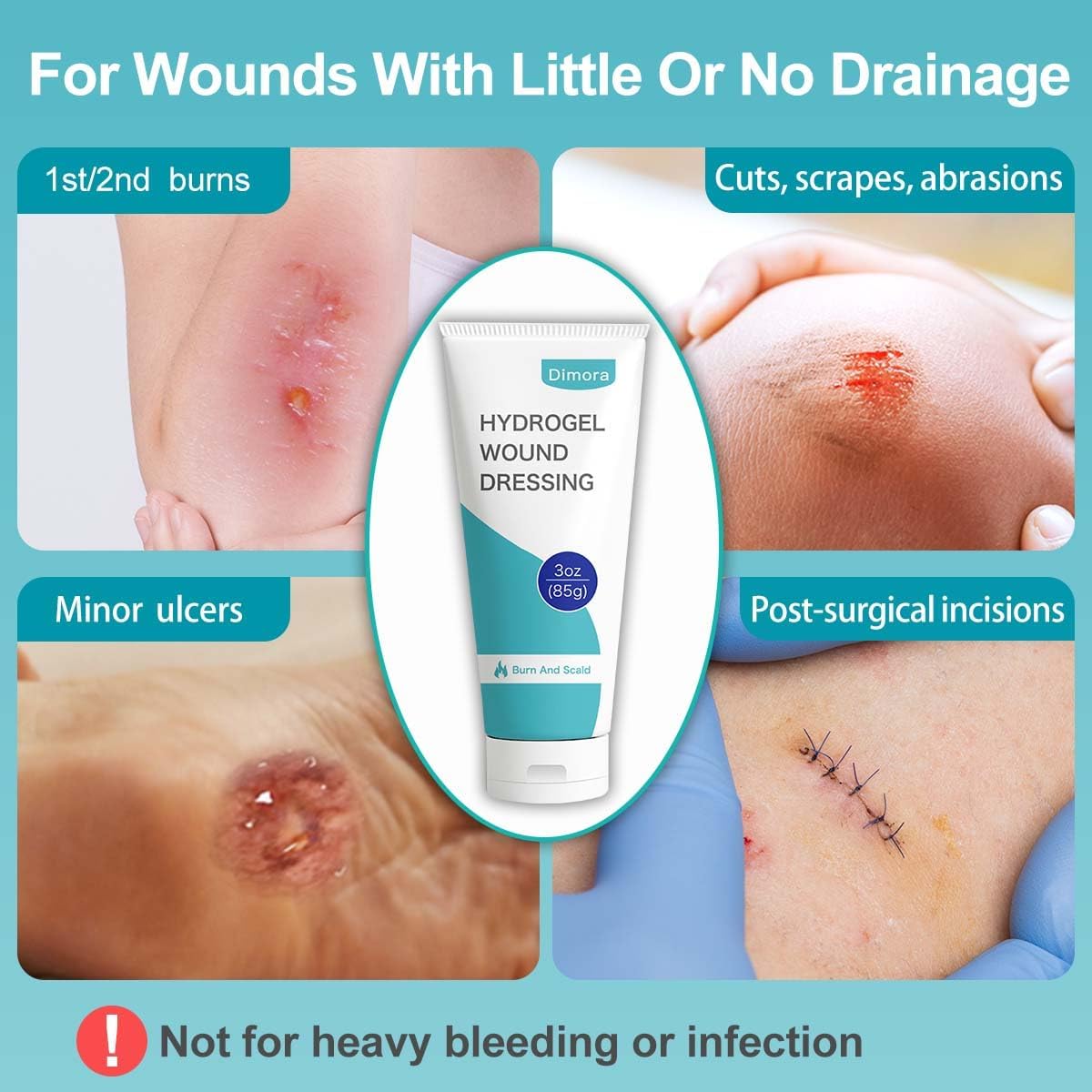 Dimora 2 Packs 6oz Hydrogel First Aid Ointment, Burn Injury Soothing Gel, Skin Repair Cream for Emergency Burn, Postoperative Incisions, Bruises, Debridement Wound Care - Image 5