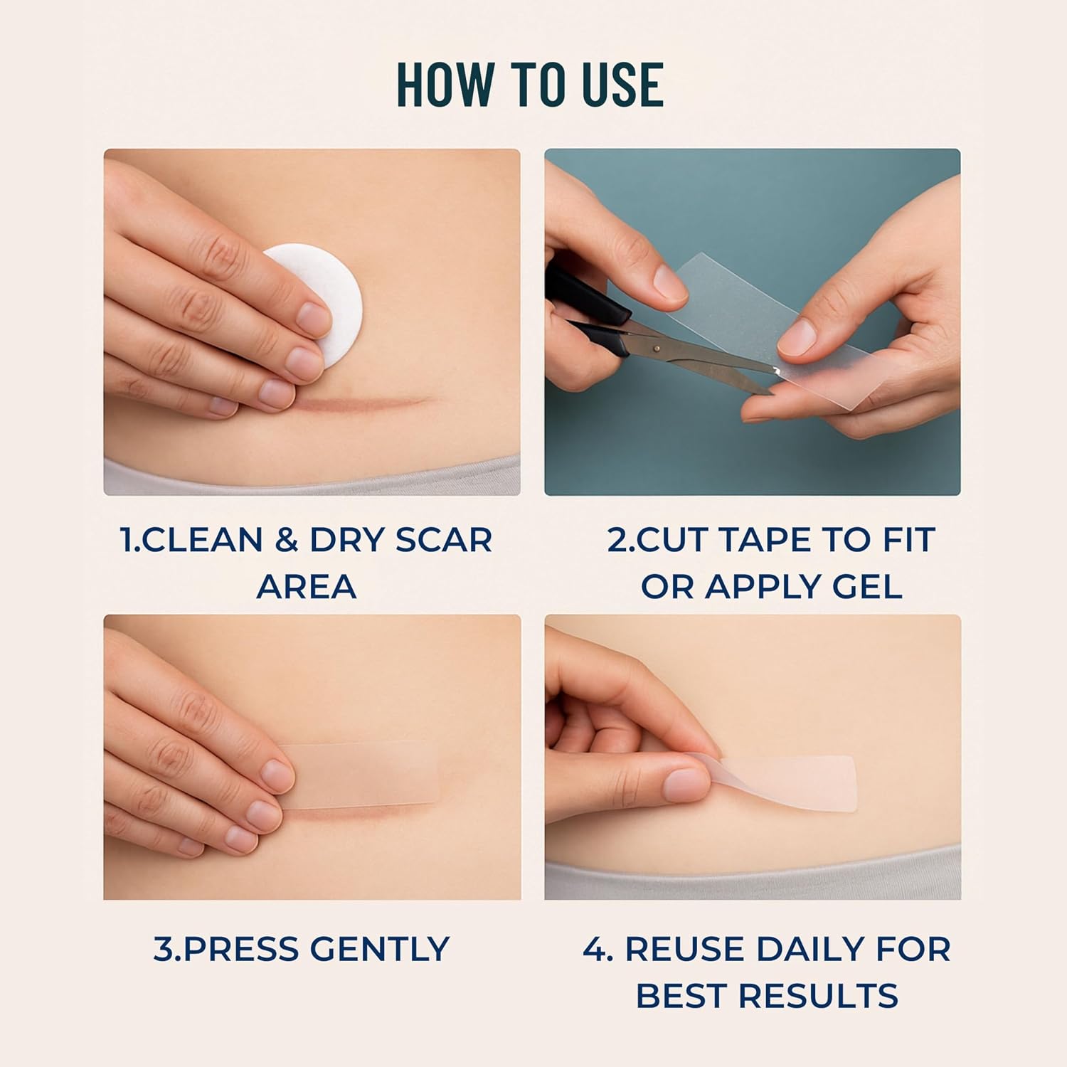 NanaCare Silicone Scar Gel with SPF 20G & Clear Silicone Scar Tape 120" x 1.5" Roll | Medical Grade Silicone Sheets and Scar Cream for C-Section, Tummy Tuck, Keloid, Face and Surgical Scars - Image 8
