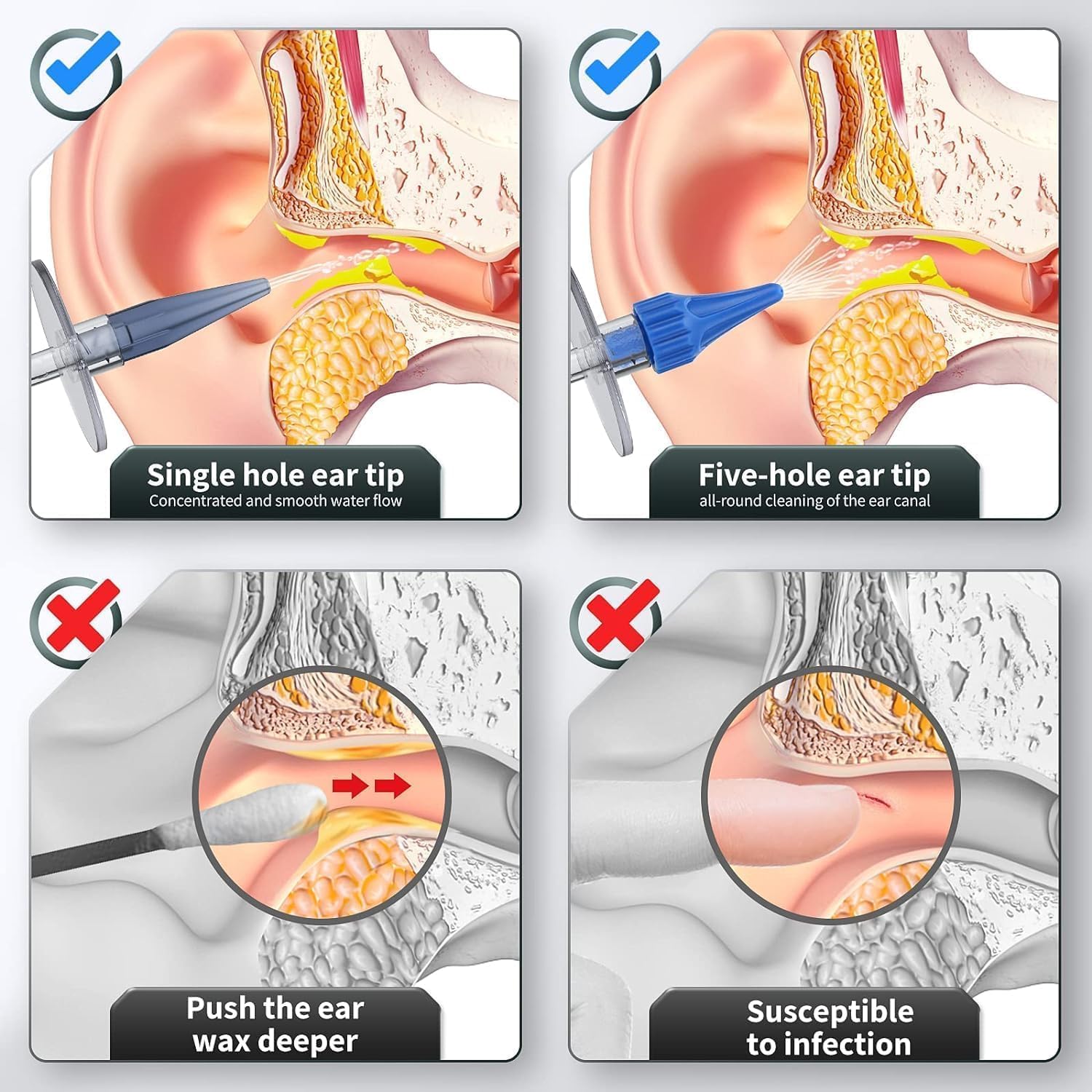 Ear Wax Removal Kit, Manual Irrigation System, Ear Cleaner - Image 5