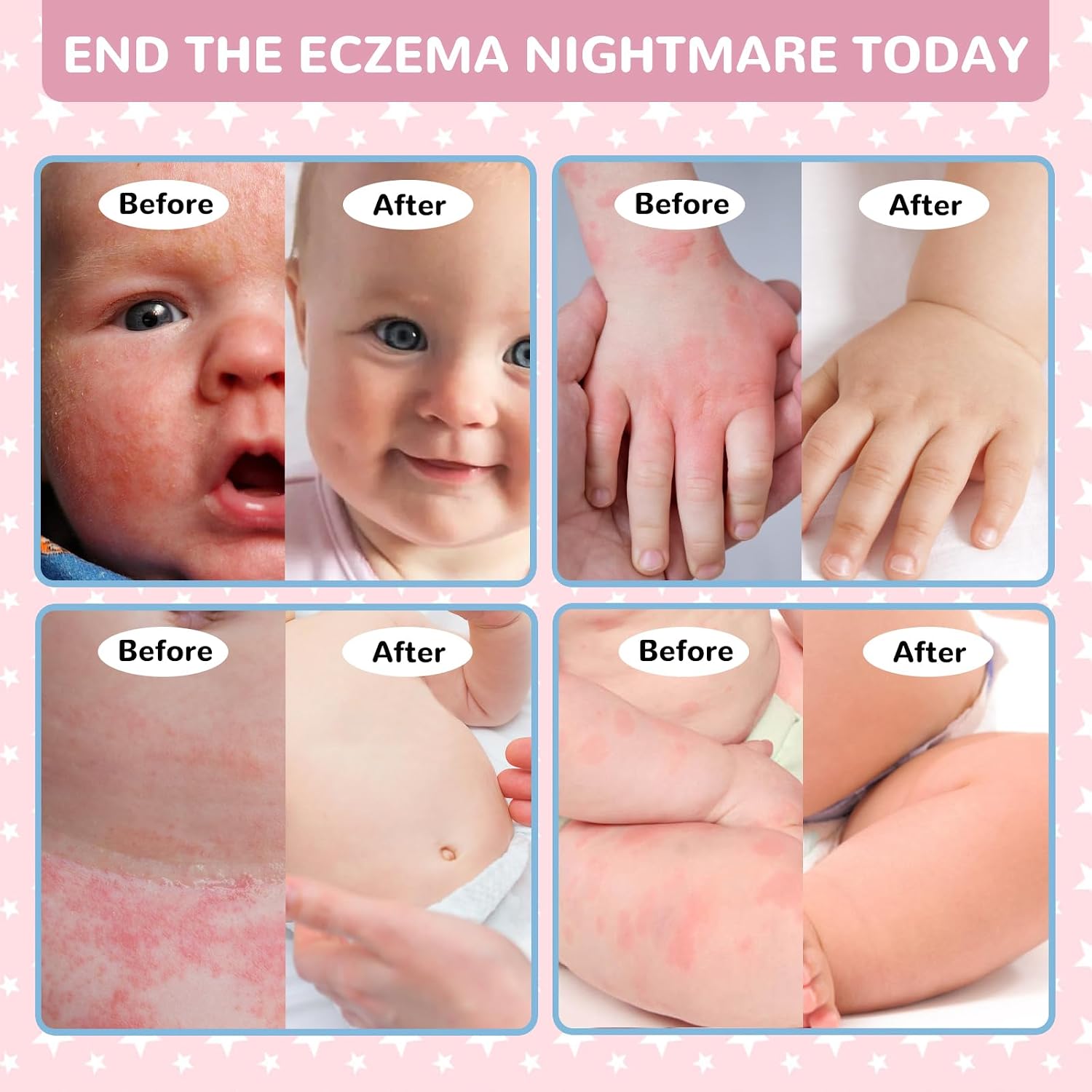 Baby Eczema Relief Cream, All-Natural Herbal Formula for Safe, Soothing Skin Protection Against Rashes, Dryness, Redness, and Itchiness, 3.53oz - Image 5