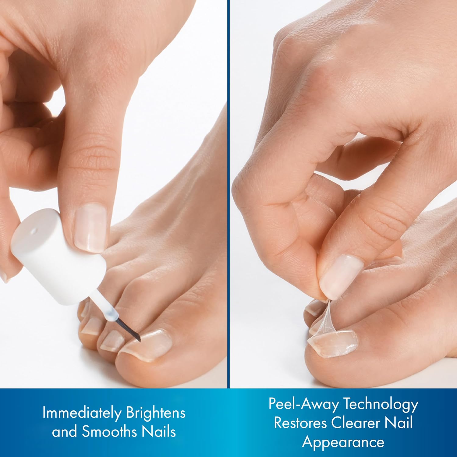 Brite Now Nail Treatment, Restores The Appearance Of Damaged & Discolored Nails, Peel-Away Technology, Brightening & Smoothing Nail Repair, 0.5 Ounce - Image 3