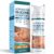 Mitgary Advanced Scar Gel, Silicone Scar Gel, Treats Old and New Scars, Reduces the Appearance of Scars from, Body, Face, Stretch Marks, Surgical Scar, Keloids, Acne, Burns and More, 50g (1.7 Oz)
