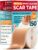 Medical Grade Silicone Scar Tape – 1.6″x150″ – Effective Scar Removal