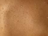 A Simple Guide to Caring for Dry and Sensitive Skin